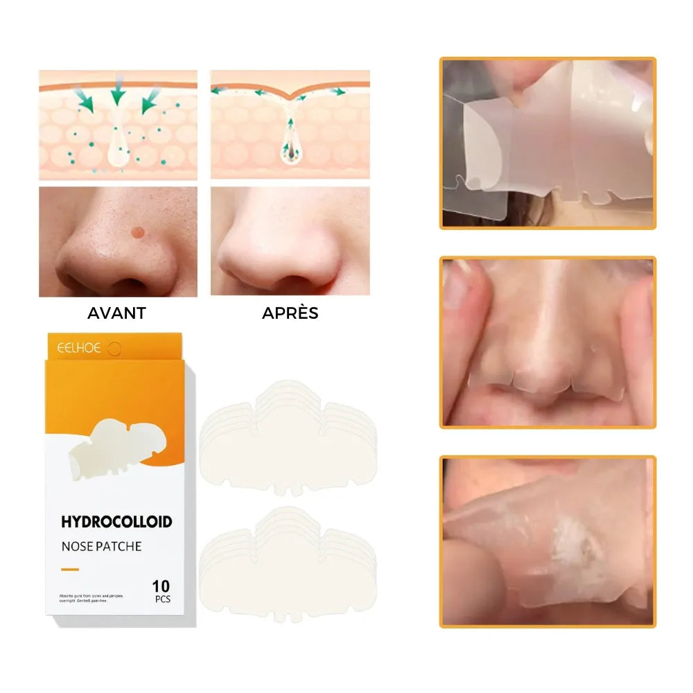 Patch Nasal Hydrocolloïde